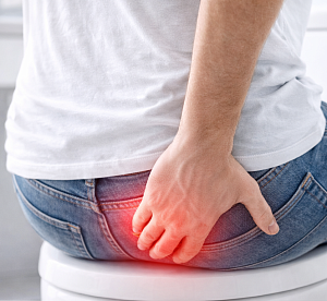 Геморрой у&nbsp;мужчин - Медицина и красота