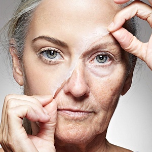 Старение кожи - Медицина и красота