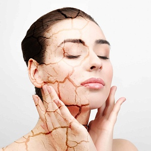 Сухая кожа - Медицина и красота