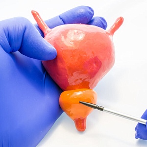 Простатит - Медицина и красота