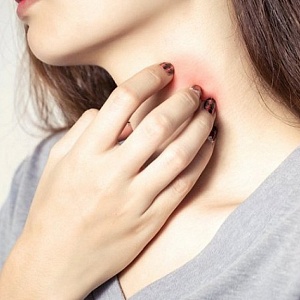 Фурункул - Медицина и красота