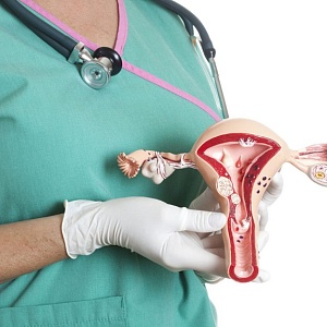 Заболевания шейки матки - Медицина и красота