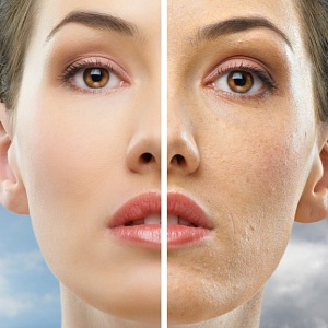 Расширенные поры - Медицина и красота