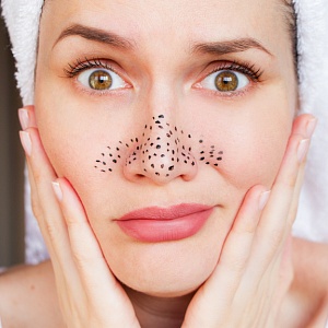 Черные точки - Медицина и красота